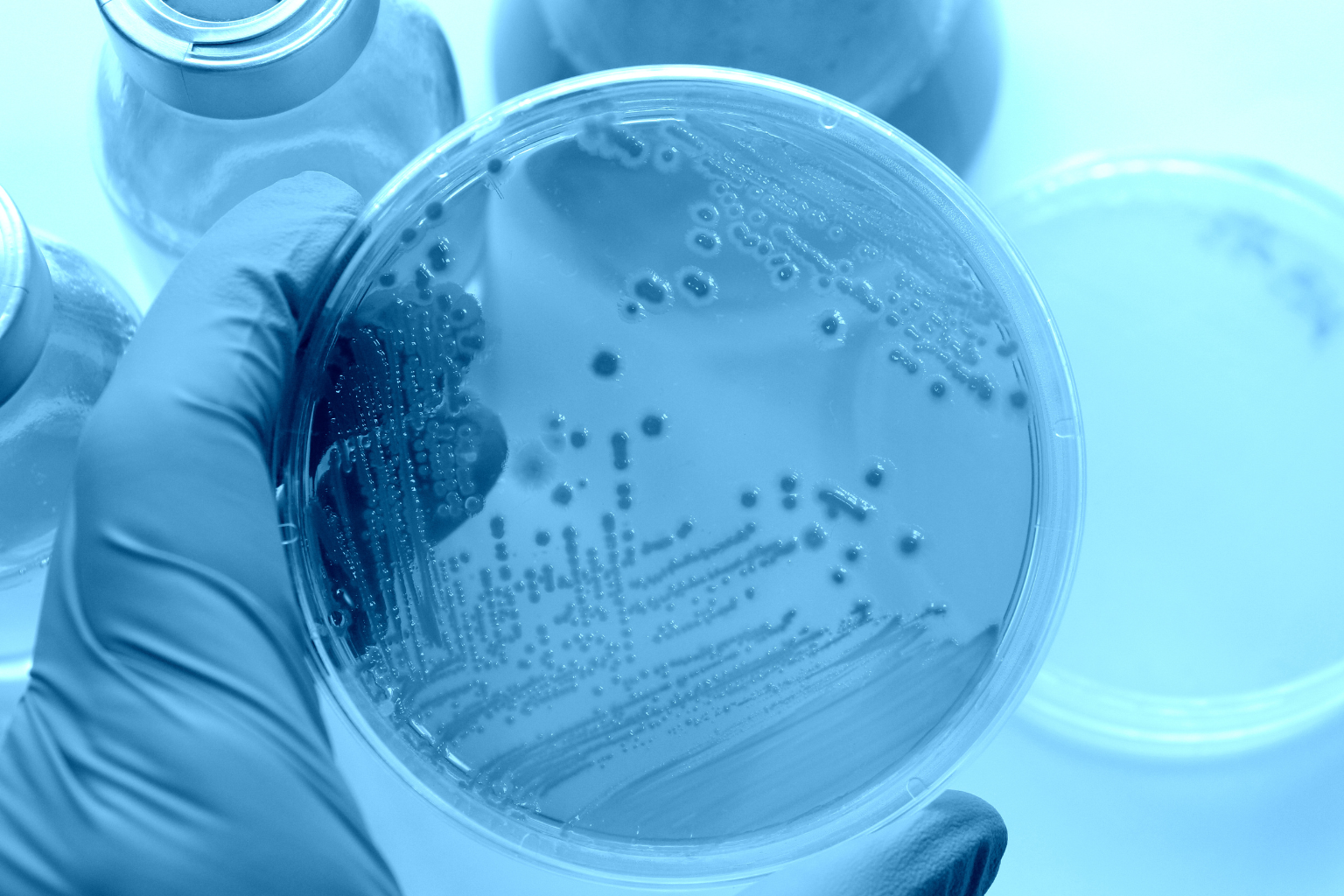 CURSO DE CONTROL MICROBIOLÓGICO Y CONSERVACIÓN DE PRODUCTOS QUÍMICOS: NUEVA EDICIÓN AMPLIADA